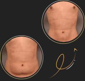 درمان جو درمان جو