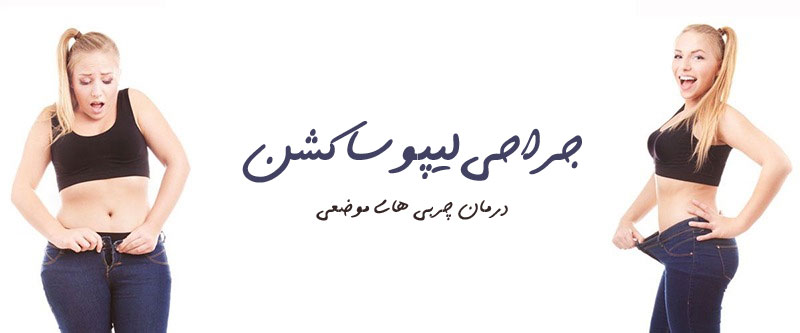 عکس قبل و بعد ساکشن شکم