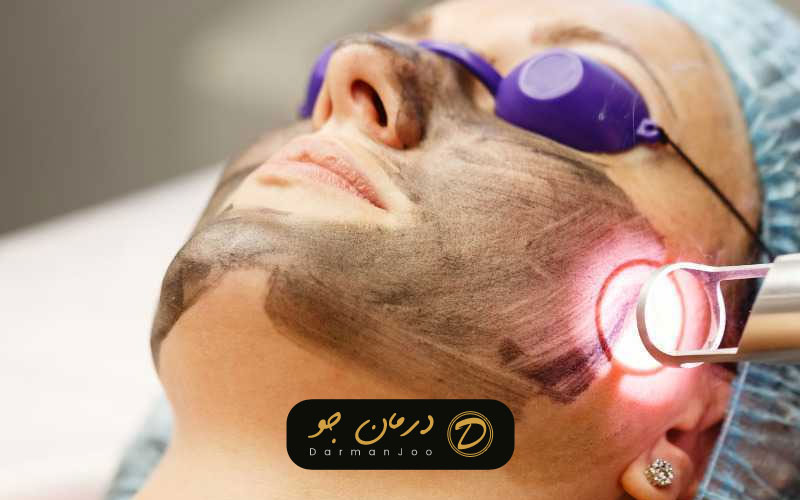 لیزر روشن سازی