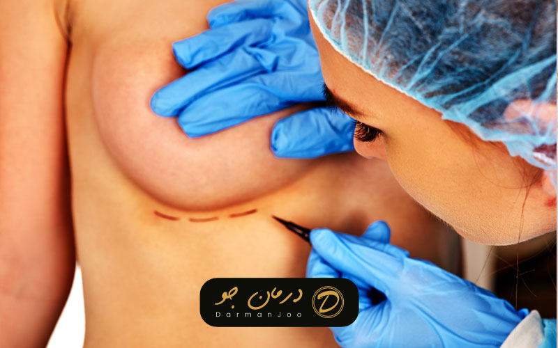 جراحی زیبایی سینه