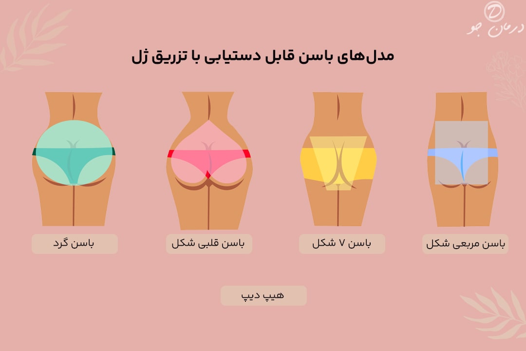 مدل‌های باسن قابل دستیابی با تزریق ژل