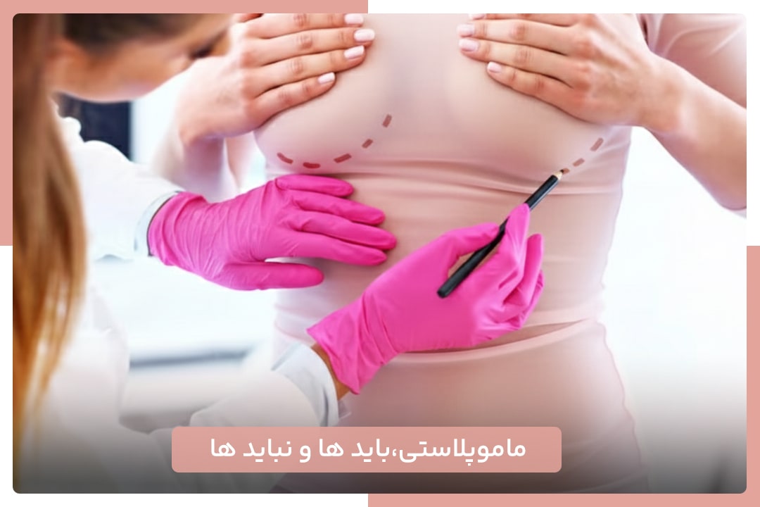 ماموپلاستی